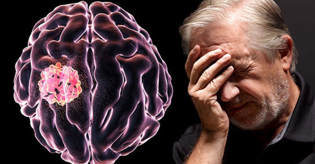 ব্রেন টিউমারের লক্ষণ
