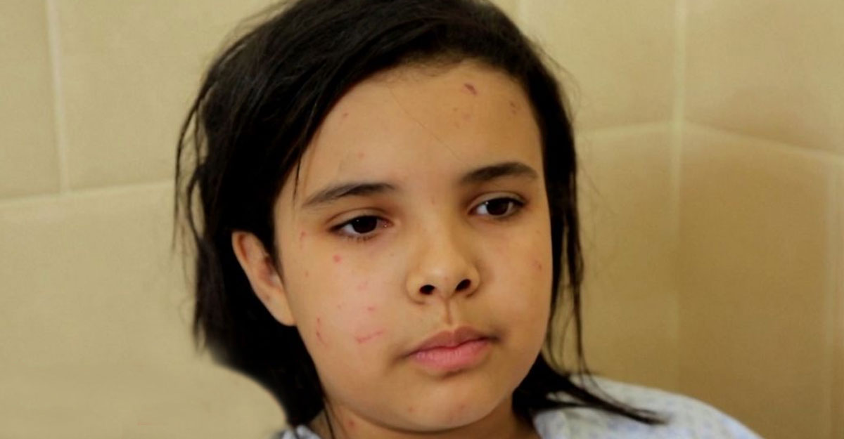 ডাক্তার হতে চায় গাজার শিশু লিন, চায় বেঁচে থাকার গ্যারান্টি