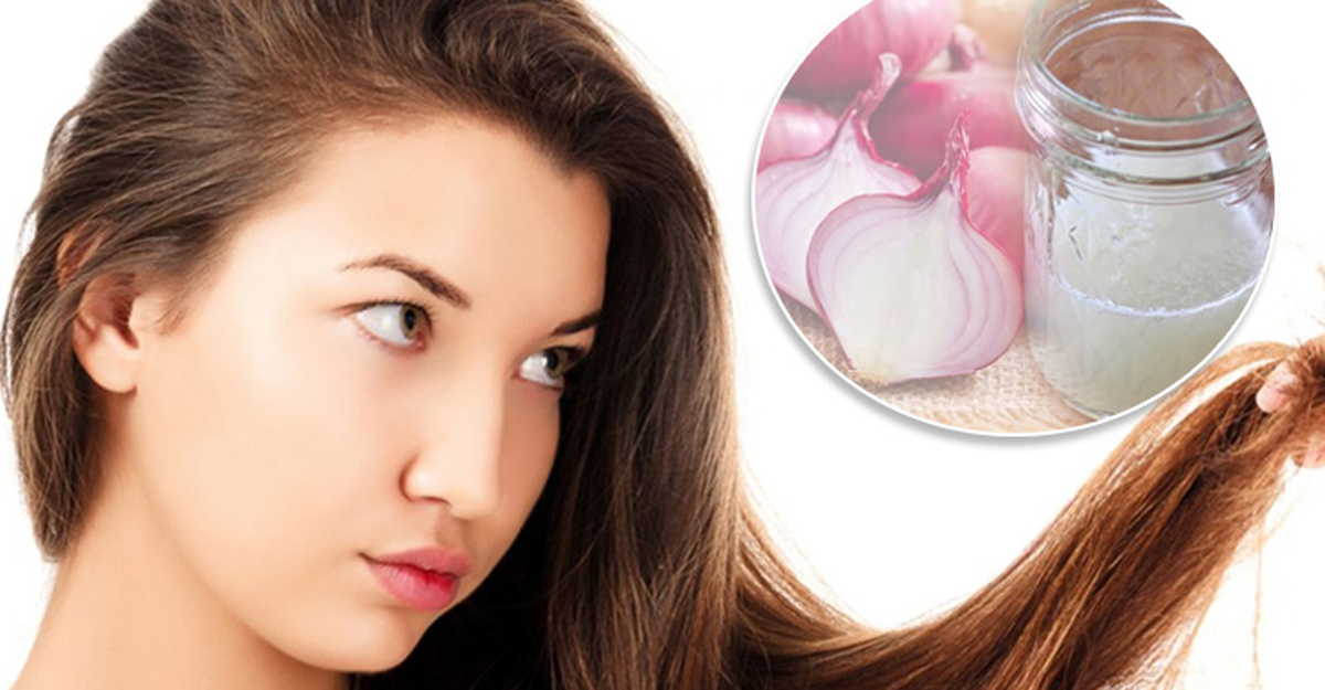 onion and hair fall
