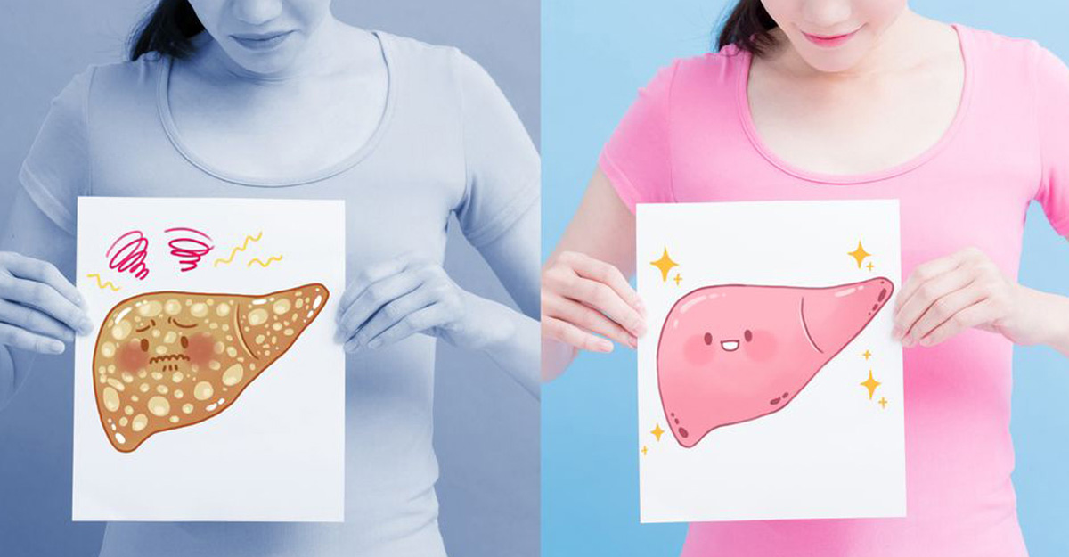 ফ্যাটি লিভার হলে কী খাবেন, কী খাবেন না