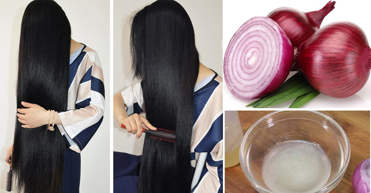 পেঁয়াজের রস আসলেই কি চুল পড়া কমায়?