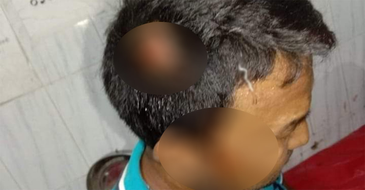 ঘুষি দিয়ে সাংবাদিকের মাথা ফাটালেন জাপা নেতা