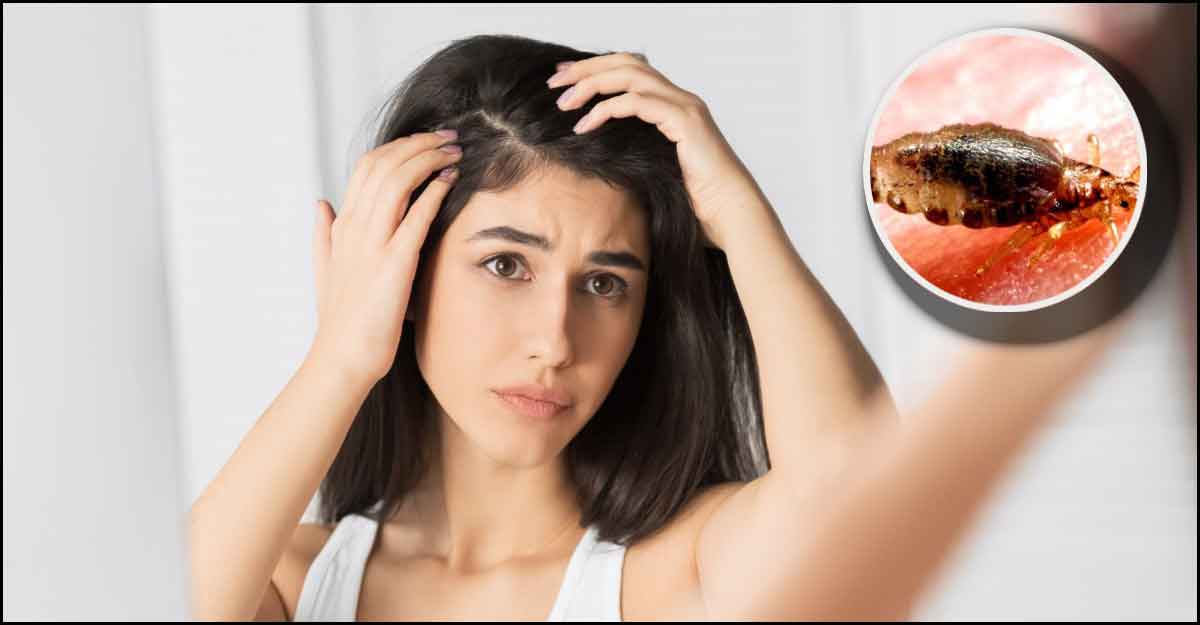 উঁকুন থেকে মুক্তির উপায়