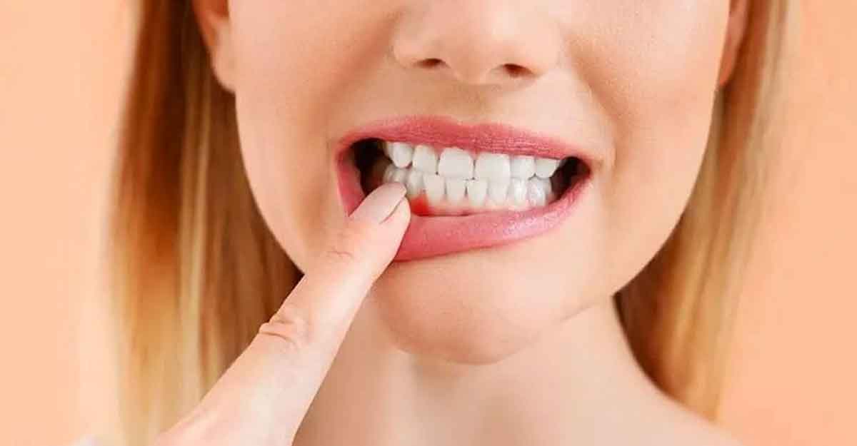 দাঁতে মাংস আটকালে কী করবেন