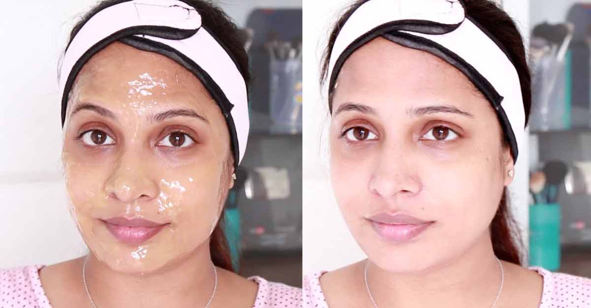 ব্লাকহেডস দূর করার সহজ উপায়