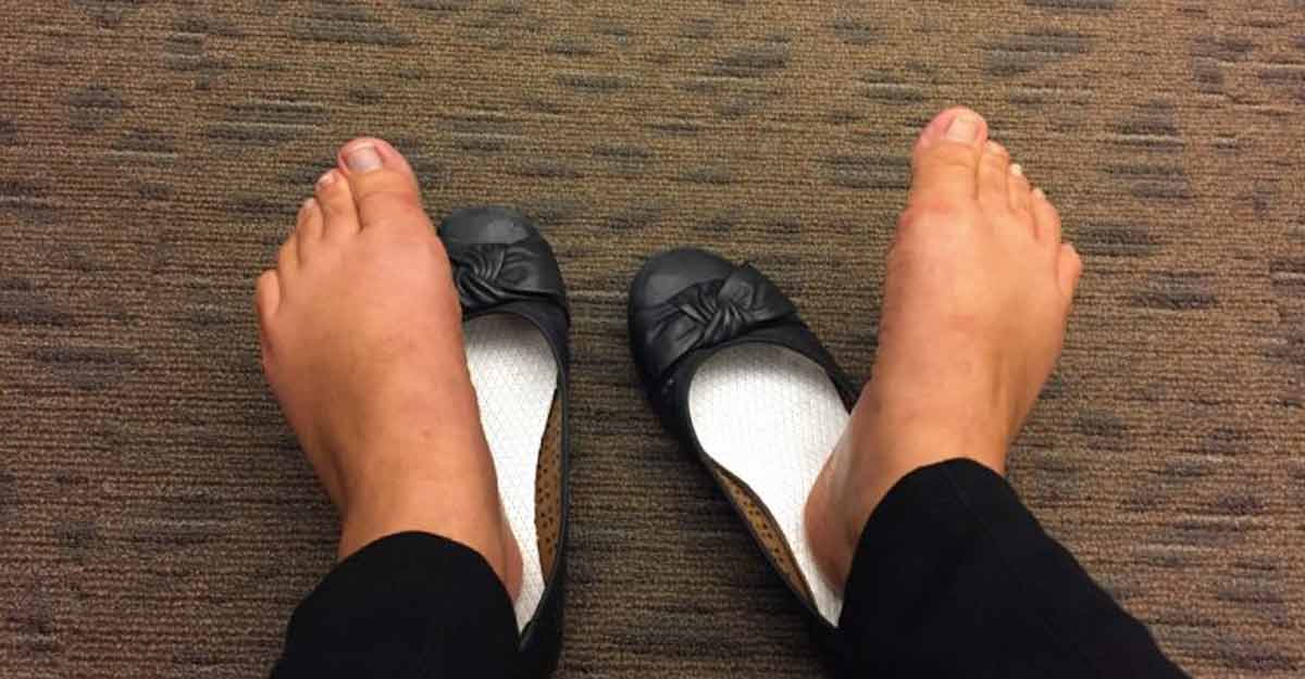 পায়ের দুর্গন্ধ দূর করার ঘরোয়া উপায়