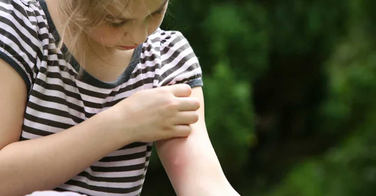 যেসব খাবার খেলে মশা বেশি কামড়ায়