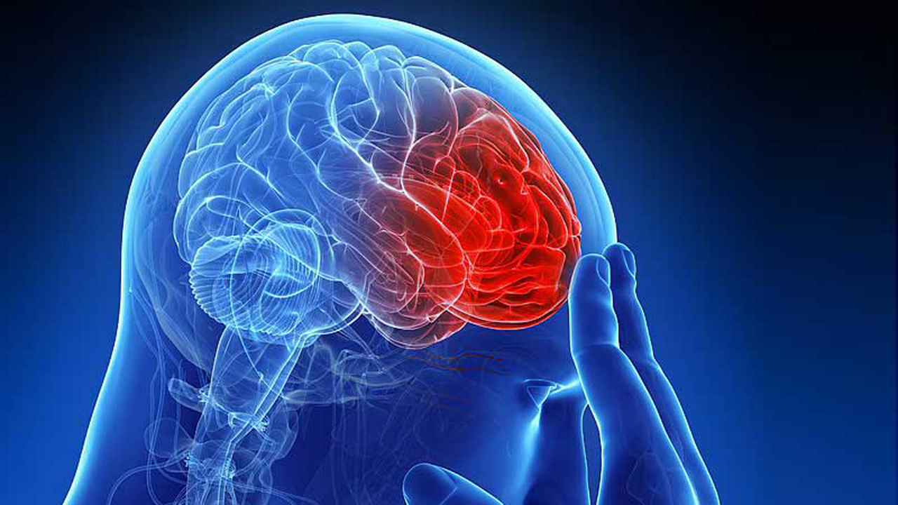 স্ট্রোকের চিকিৎসা ও প্রতিরোধে করণীয়