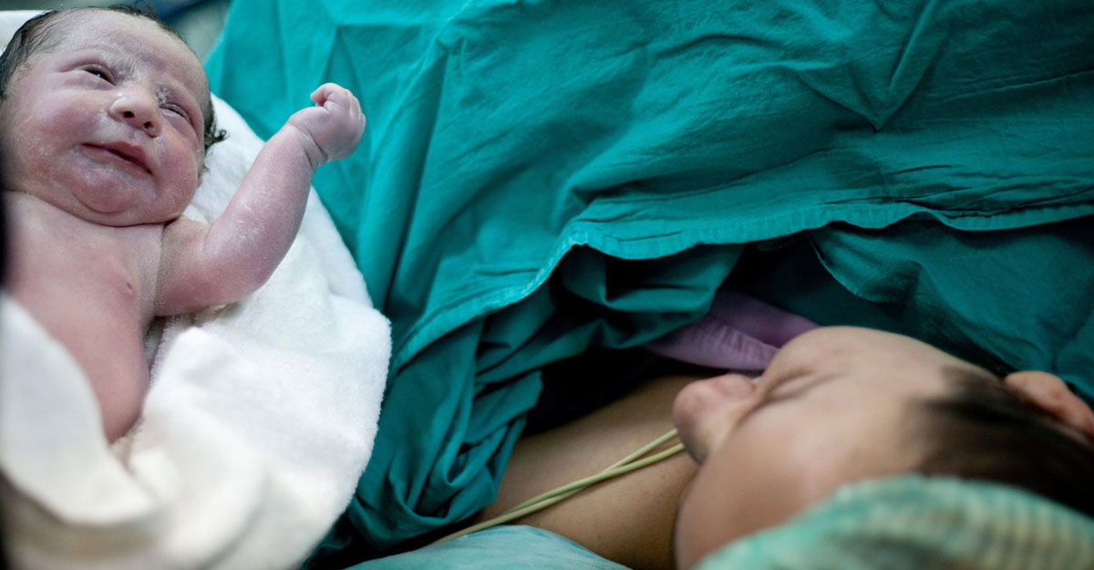 cesarean delivery