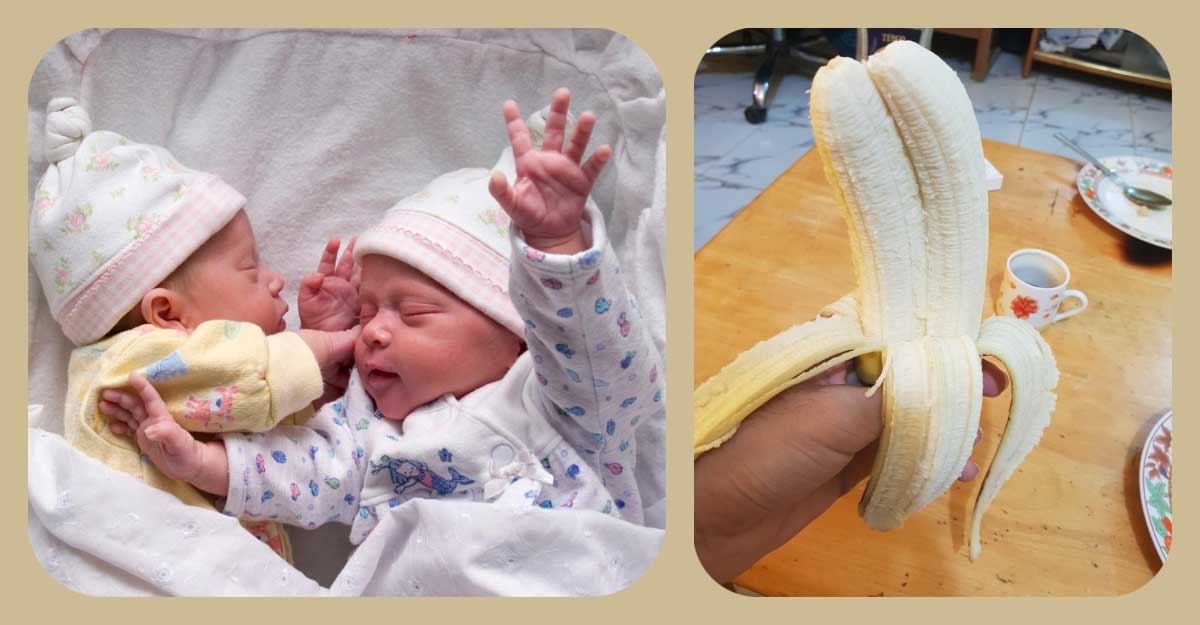 জোড়া কলা খেলে কি যমজ সন্তান হয়?