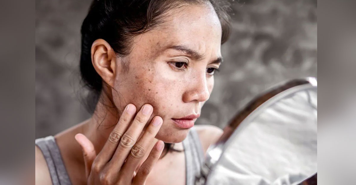 ত্বকের কালো দাগ দূর করার উপায়