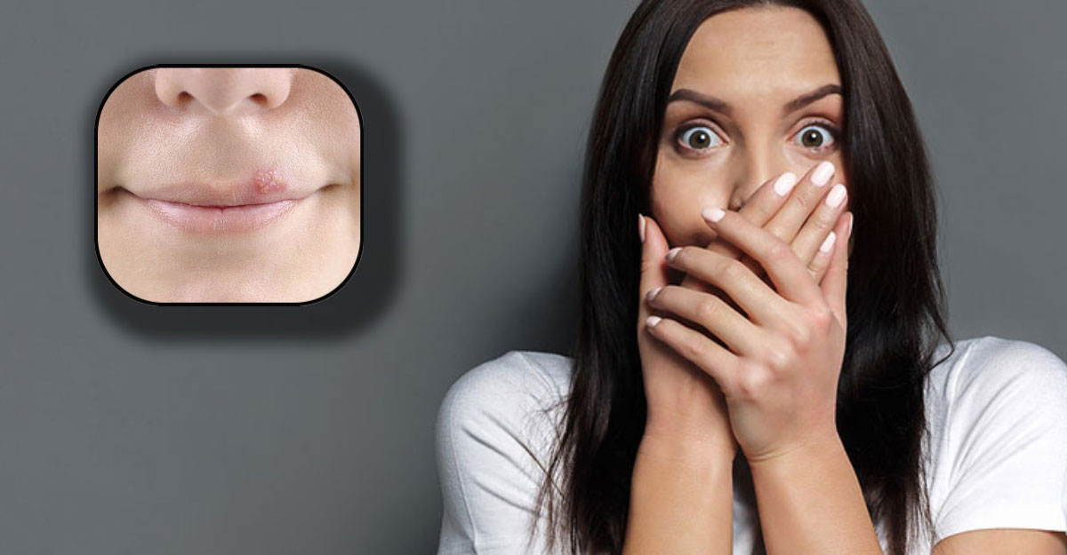 জ্বরঠোসা কী, হলে কী করবেন?