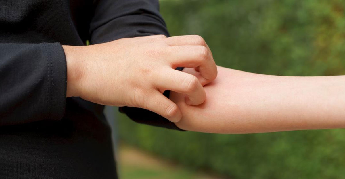 গরমে বাড়ছে চুলকানি, বাঁচবেন কীভাবে