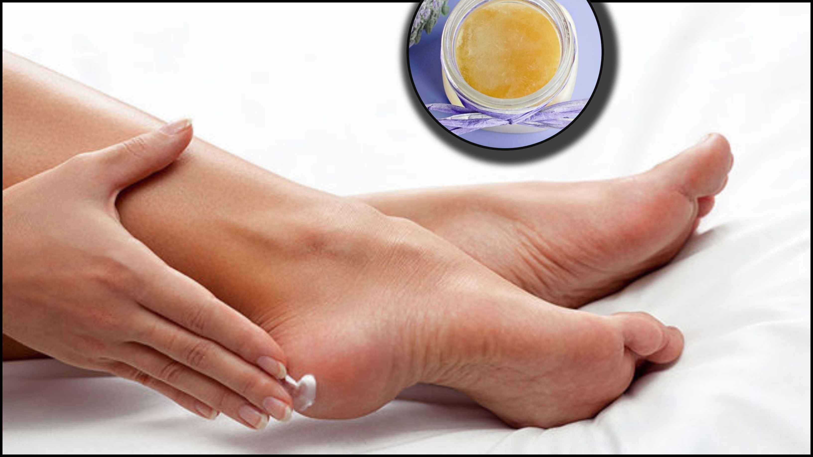 শীতকালে পা ফাটে, বাড়িতেই বানান ফুট ক্রিম