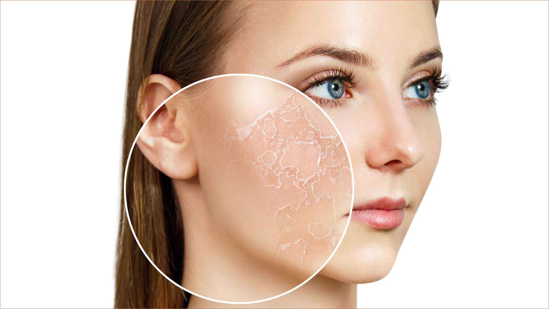 ত্বকের আর্দ্রতা কমছে কি না বোঝার উপায়