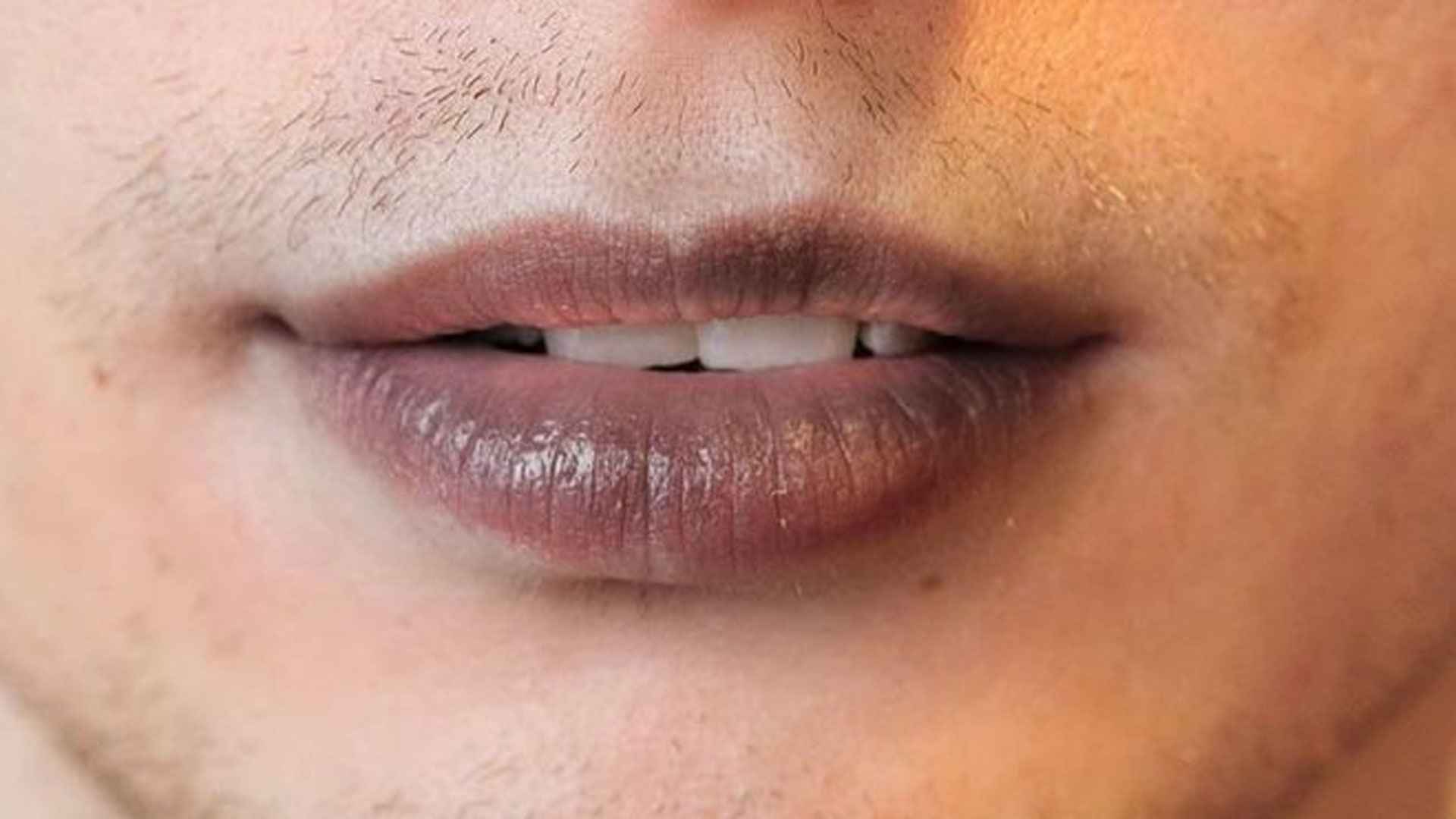 কালচে ঠোঁট গোলাপি করার ঘরোয়া উপায়