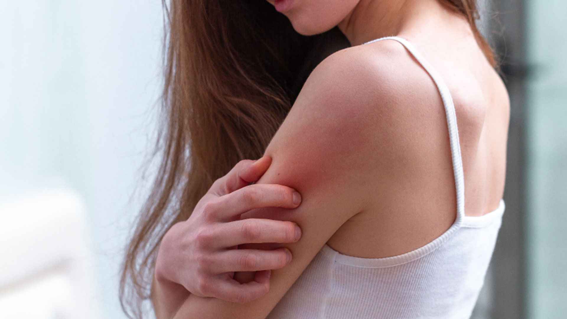 গরমে ঘামাচি থেকে মুক্তির উপায়