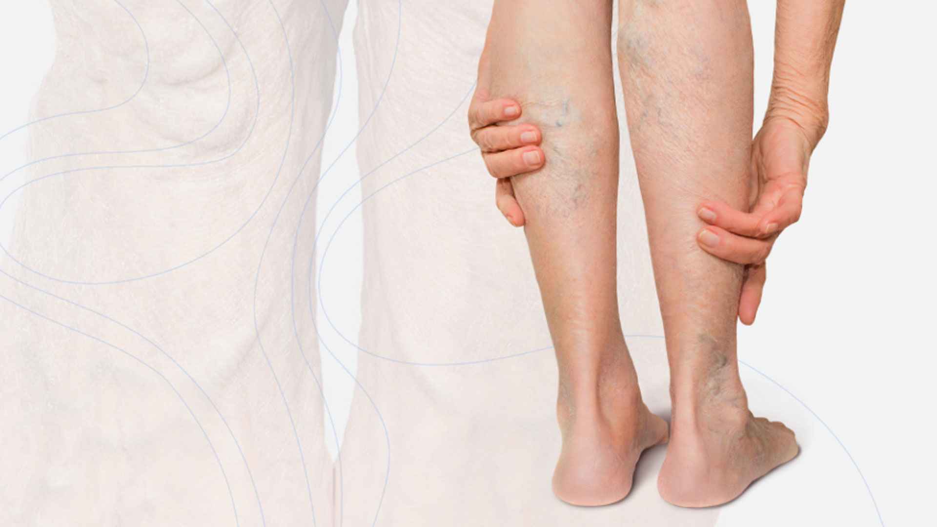 ত্বকের উপর নীল শিরা-উপশিরা, পেশিতে টান— নারীরা এই রোগে ভোগেন বেশি