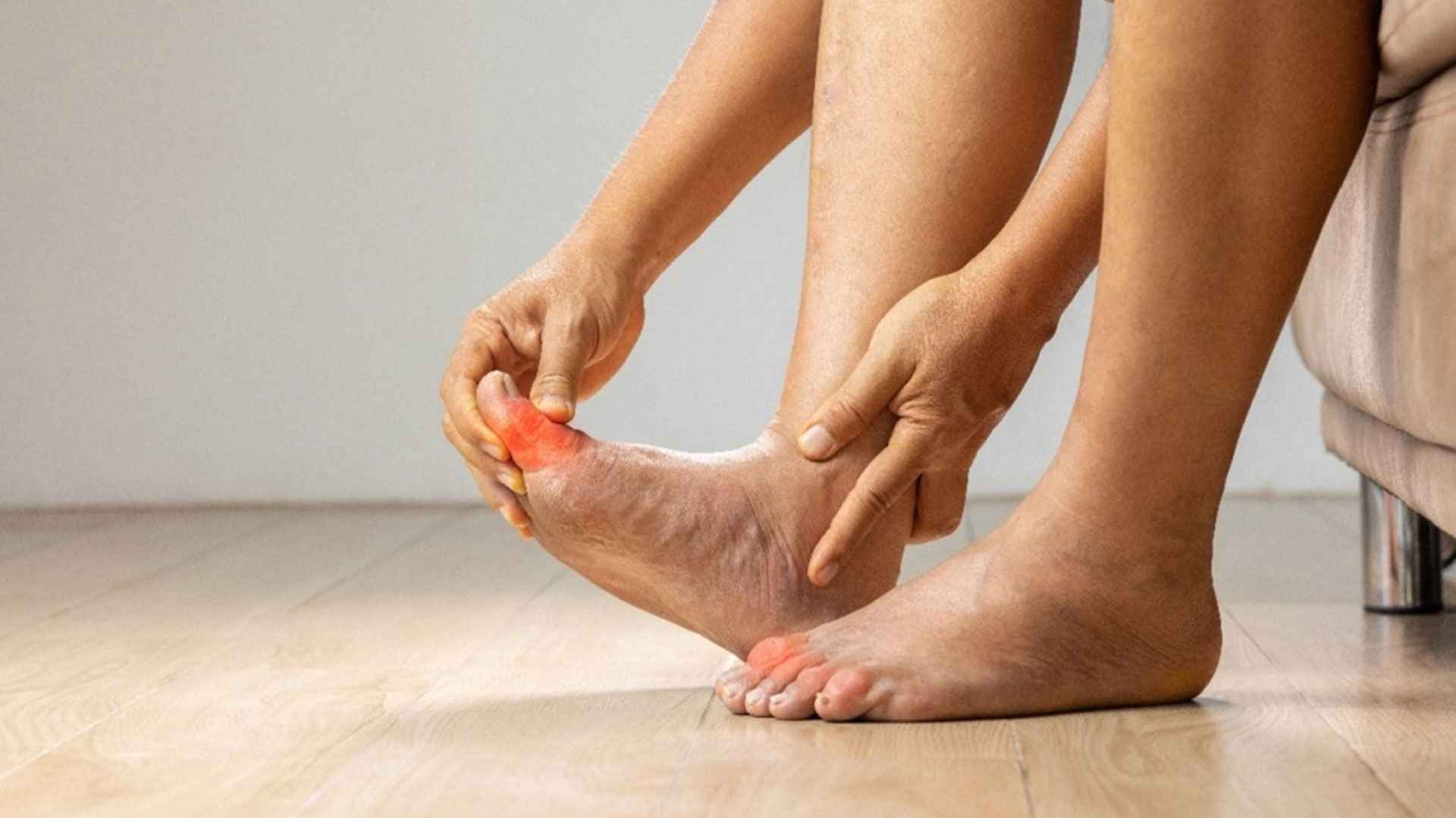 ইউরিক অ্যাসিড নিয়ন্ত্রণে রাখে ভিটামিন বি ১২ যুক্ত এসব ফল