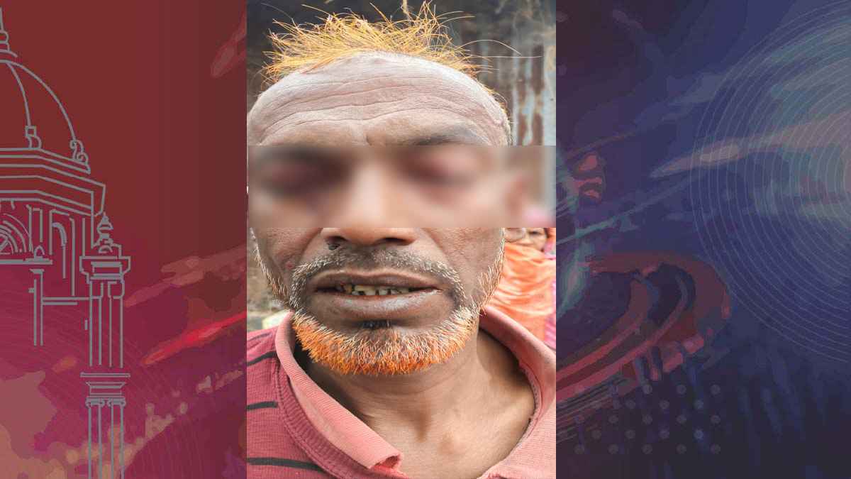 চা বিক্রেতার চোখে চাবি ঢুকিয়ে দিল মাদক কারবারিরা