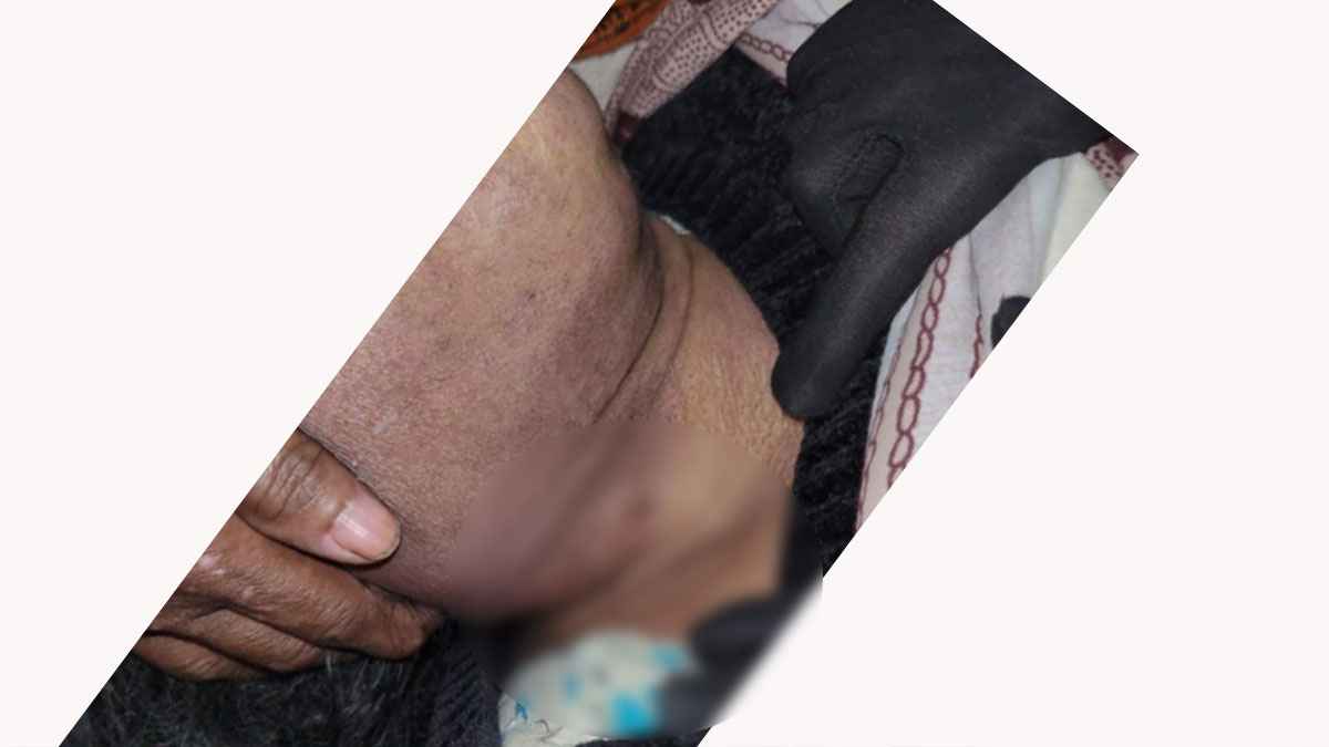 সিদ্ধিরগঞ্জে বৃদ্ধা নারীর মরদেহ উদ্ধার, গলায় আঘাতের চিহ্ন