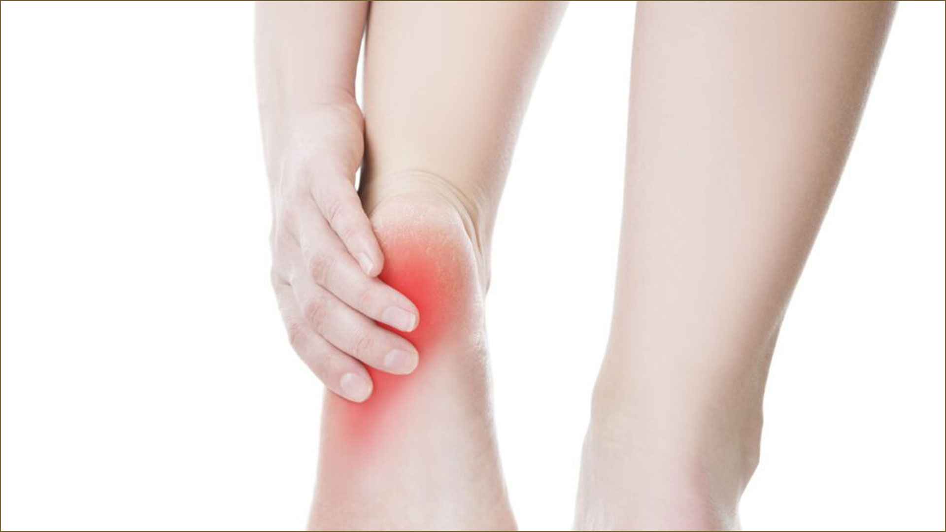 শীতে বাড়ে গোড়ালি ব্যথা, কমাতে করণীয়