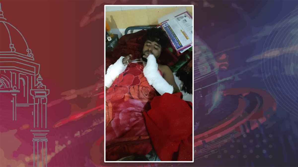 ঈগলের পক্ষে কাজ করায় যুবকের হাত-পা ভেঙ্গে দিলো সাবেক এমপির কর্মীরা