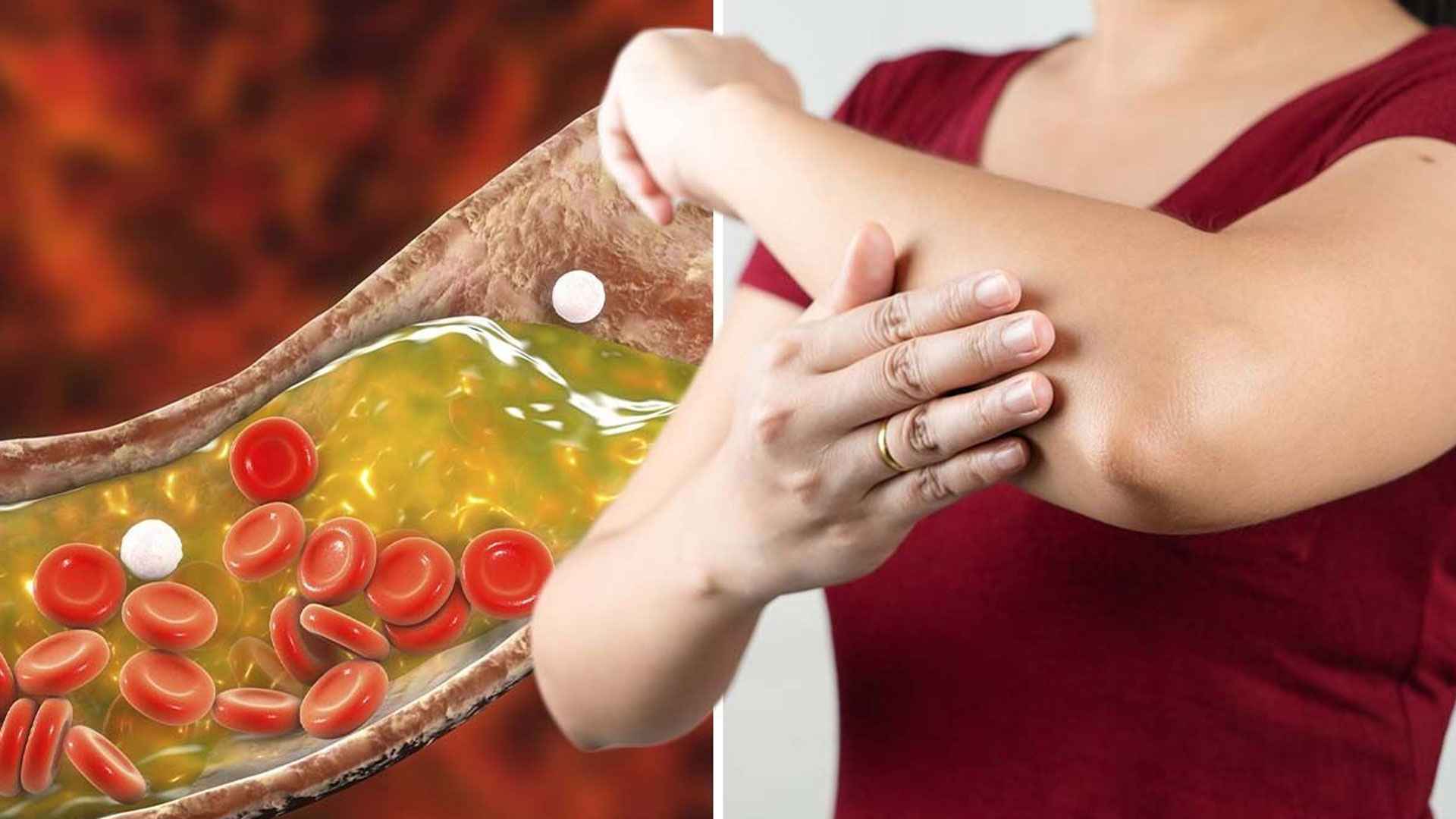 নিরবে বাড়তে পারে কোলেস্টেরল, এসব ইঙ্গিত দেখলেই সাবধান!