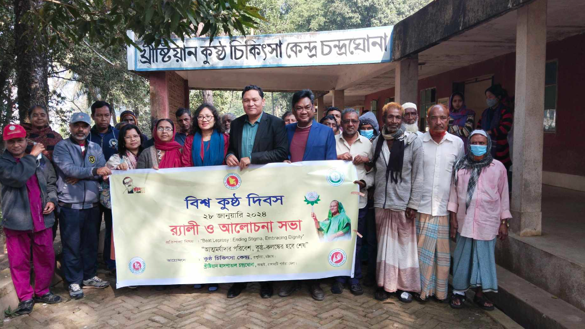 কুষ্ঠ রোগীদের নিয়ে চন্দ্রঘোনায় ‘বিশ্ব কুষ্ঠ দিবস’ পালন