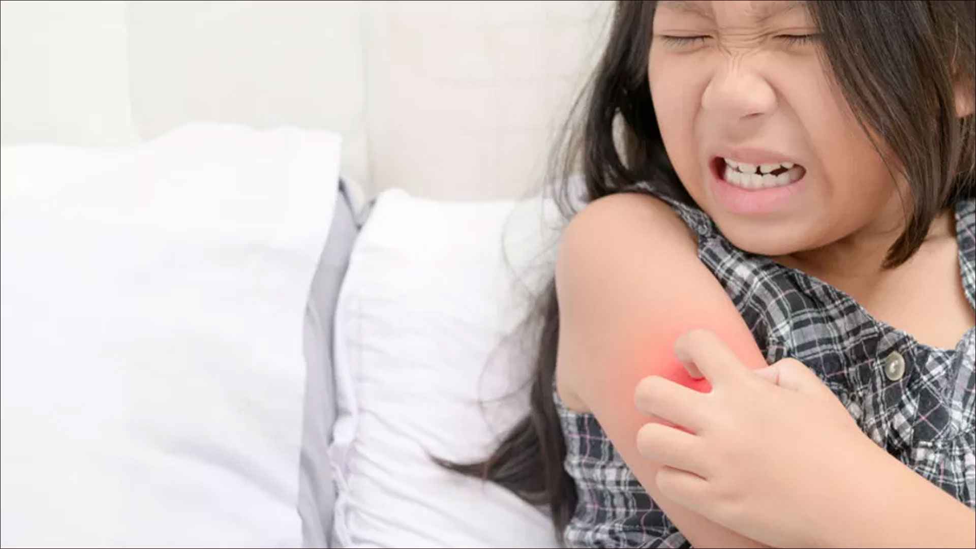 দাদ কমানোর ঘরোয়া উপায় 