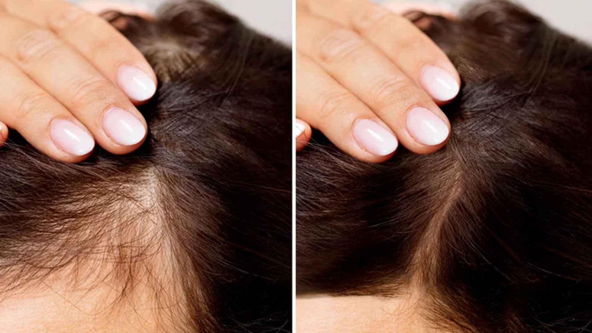 পেঁয়াজ-কফির জাদুতে বাড়বে চুলের ঘনত্ব 