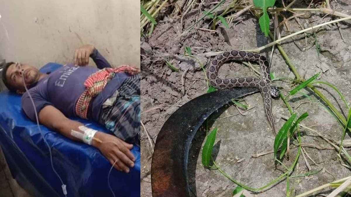 রাসেল ভাইপারের কামড়ে আহত কৃষক সাপ নিয়ে হাসপাতালে