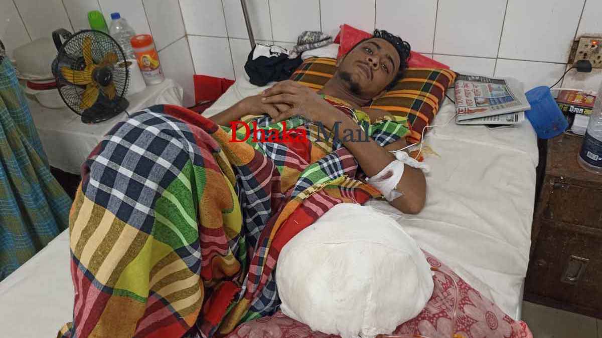 ‘দোকানের শাটার তুলে কাছ থেকে আমার পায়ে গুলি করে পুলিশ’