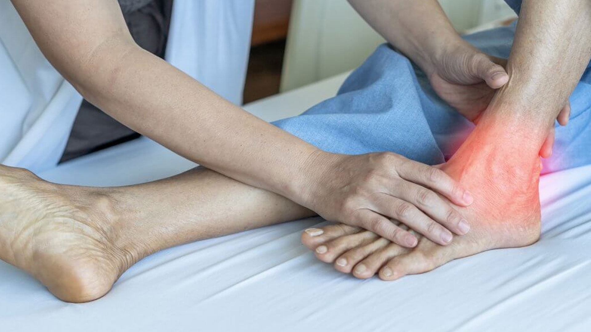 uric-acid3 uric-acid3