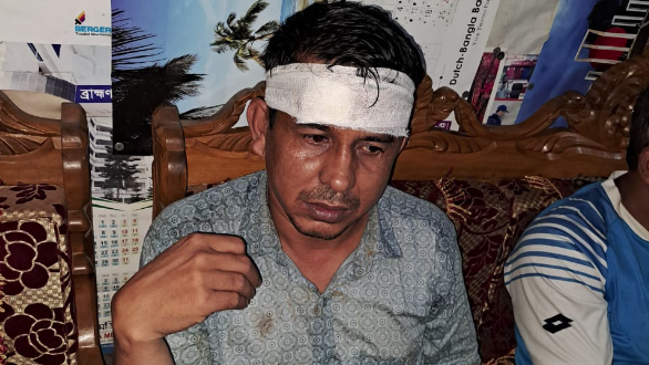 বিজয়নগরে ইউপি চেয়ারম্যানের মাথা ফাটালো পুলিশ 