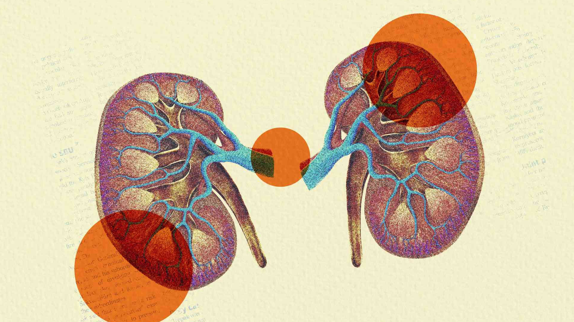 kidney2 kidney2