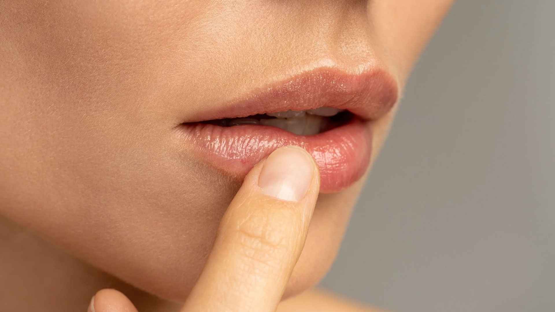 রোদে পুড়তে পারে ঠোঁটও, ক্ষতি এড়াতে করণীয়