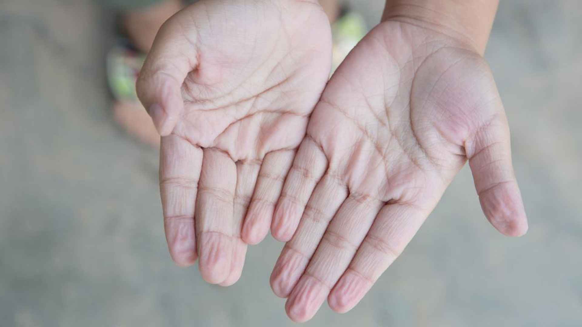 বেশিক্ষণ পানি ঘাঁটলে হাতের চামড়া কুঁচকে যায় কেন?