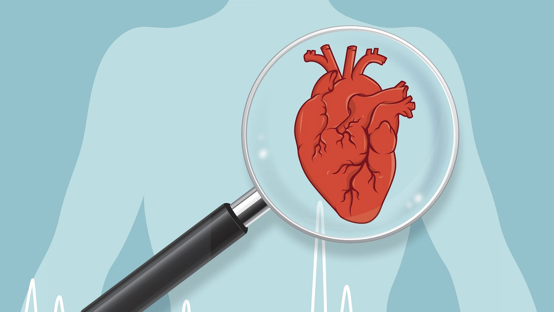 heart-attack2 heart-attack2