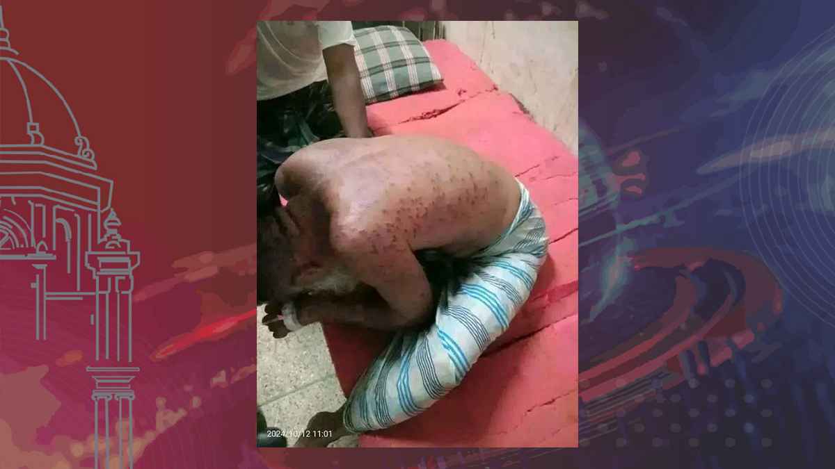 ভিমরুলের কামড়ে দুই সন্তানসহ প্রাণ গেল ইমামের