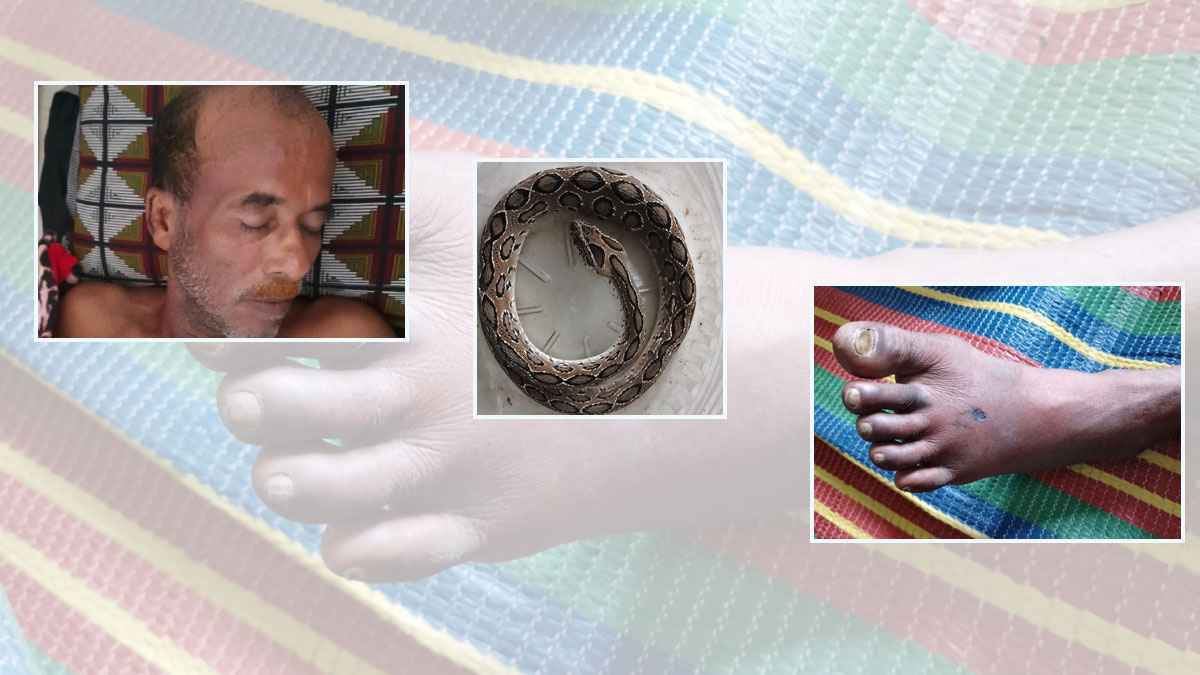 কামড় দেওয়া রাসেল ভাইপার নিয়েই নিজেই এলেন হাসপাতালে