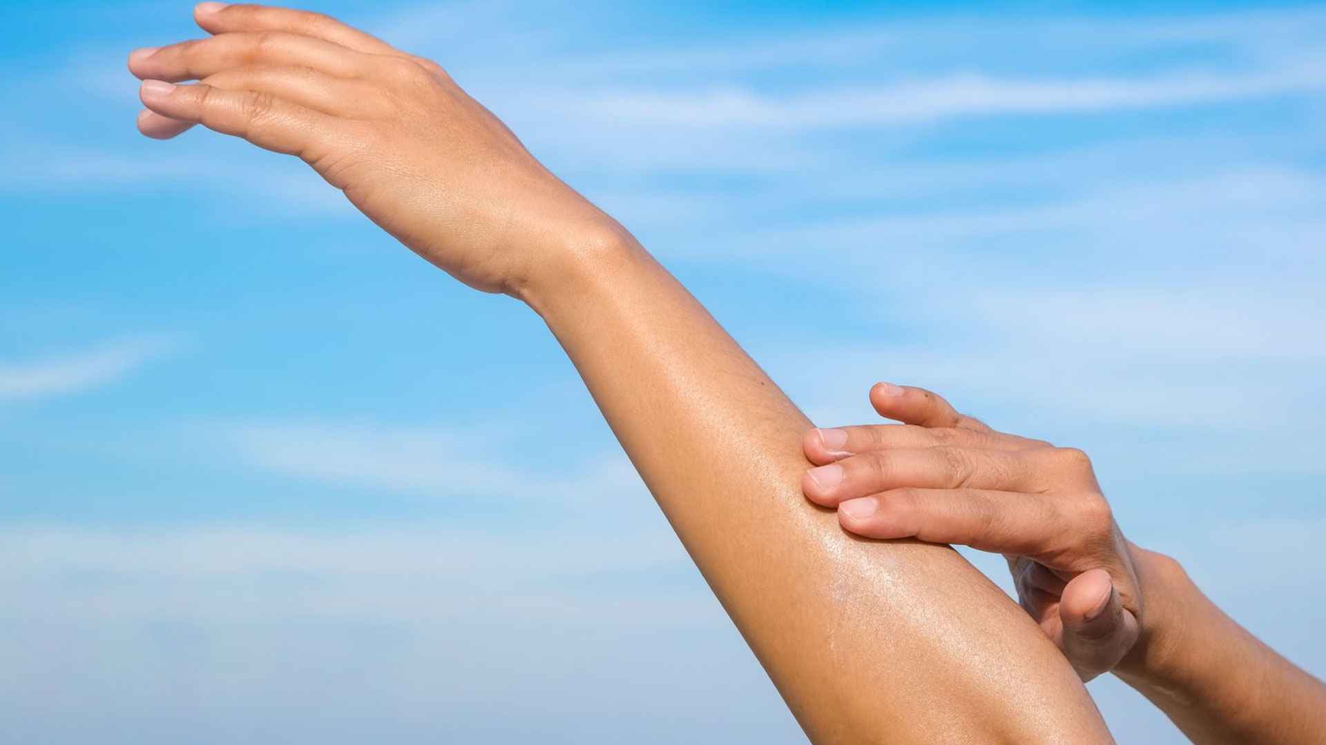 রোদে ঘুরে হাতে কালচে ভাব? দূর করবেন যেভাবে