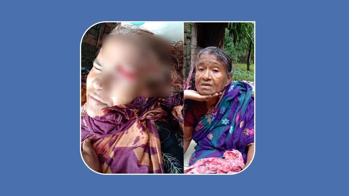 সাতক্ষীরার পাগলা কুকুরের কামড়ে গুরতর আহত ৮