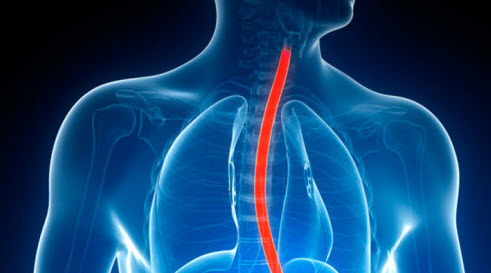 esophagus2 esophagus2