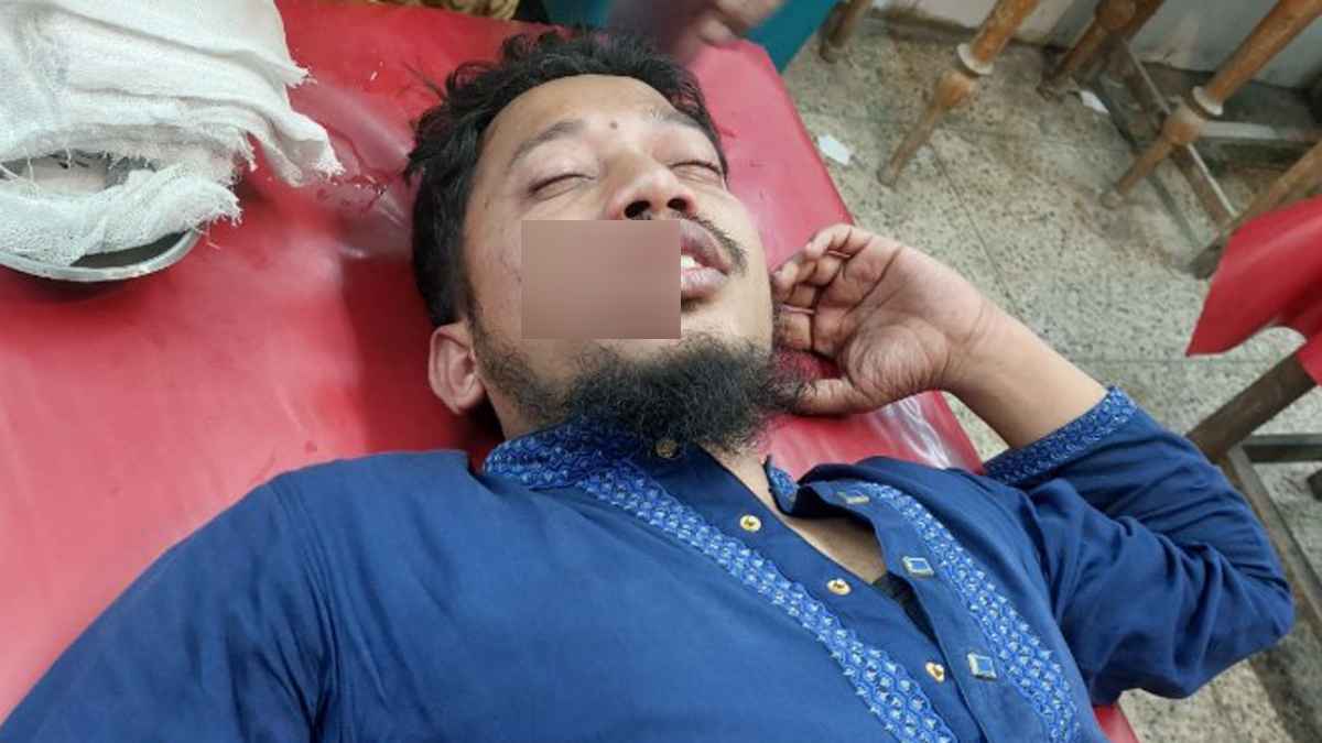 গোবিপ্রবি ছাত্র অধিকার পরিষদের সদস্য সচিবের ওপর হামলা