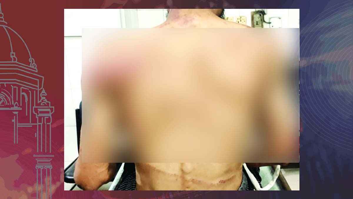 স্বেচ্ছাসেবকদল নেতাকে হত্যা চেষ্টা, যুবলীগকর্মীসহ ৮ জনের নামে মামলা