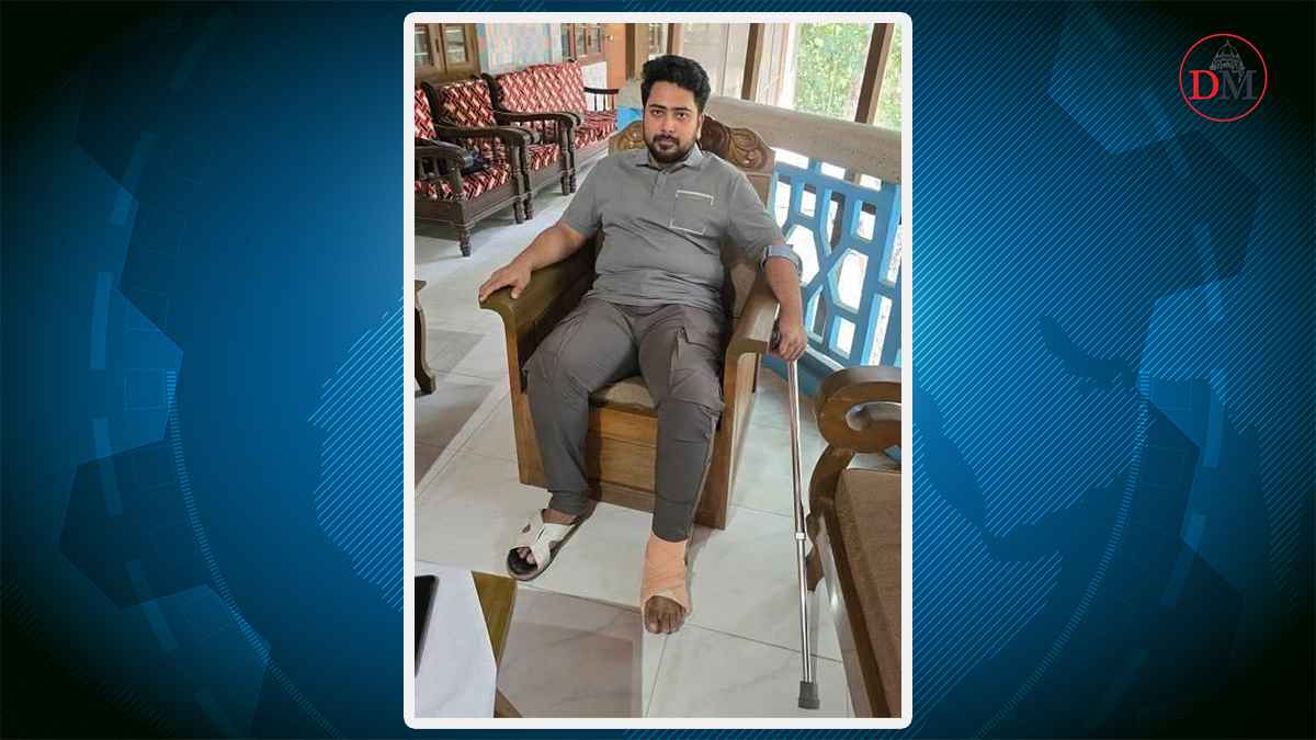 পায়ে ব্যথা পেয়েছেন নাহিদ ইসলাম!