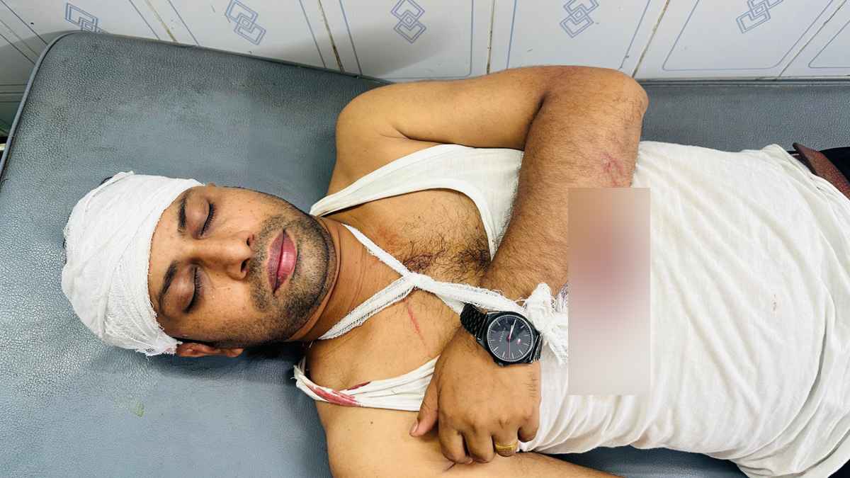 বিজয়নগরে সাংবাদিক রুবেলের ওপর সন্ত্রাসী হামলা