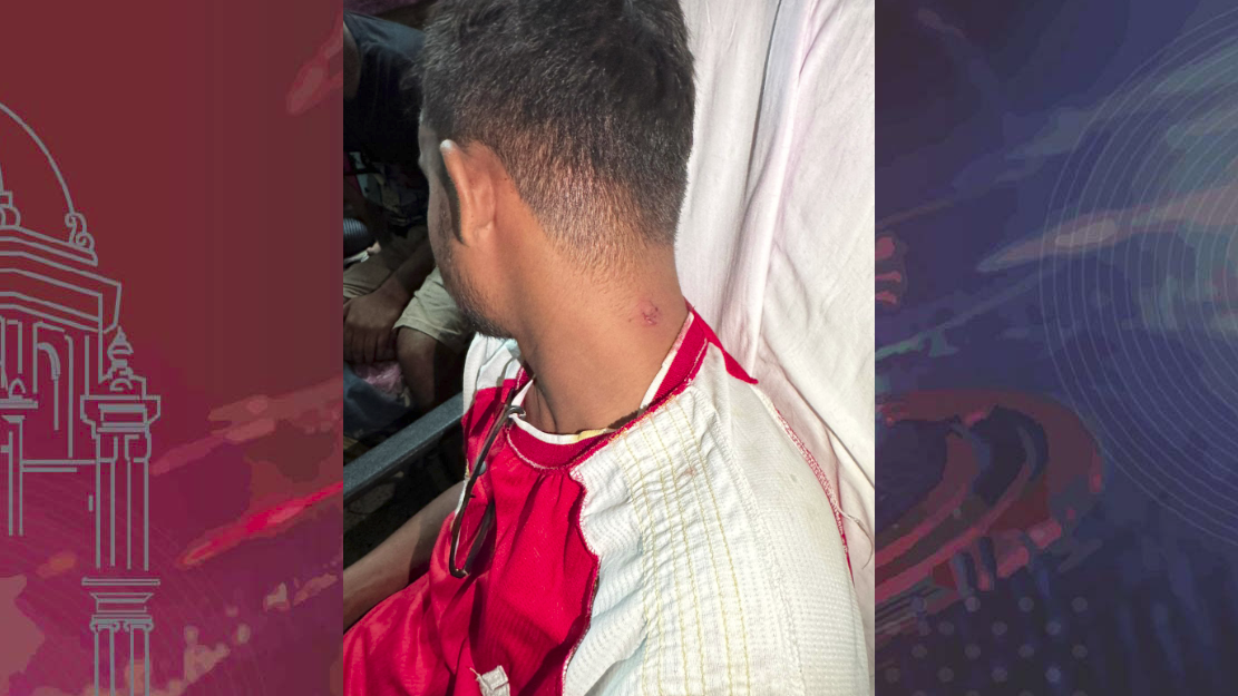 ছাত্রদল নেতা শফিকের ঘাড়ে কামড় দেওয়ার অভিযোগ বাদশার বিরুদ্ধে