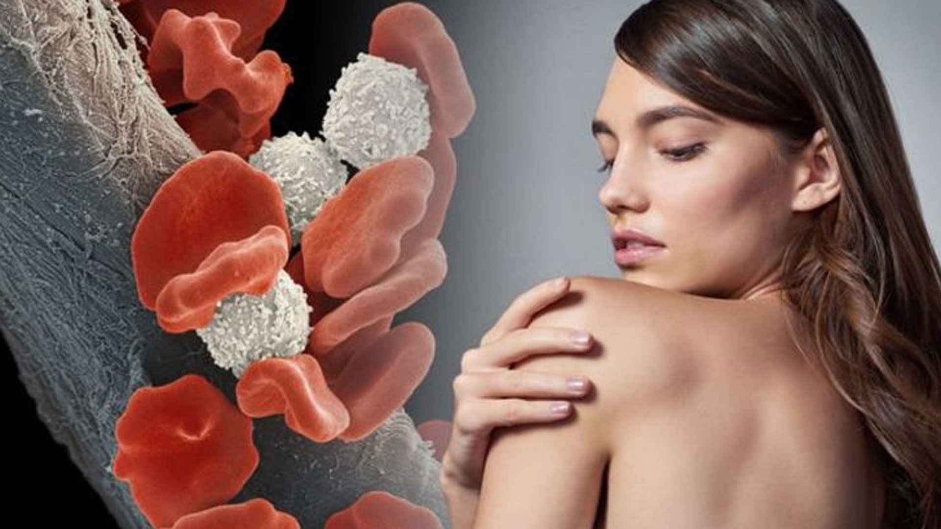 ব্লাড ক্যানসারের লক্ষণ কী কী?